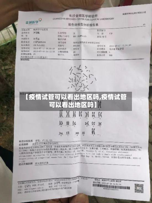 【疫情试管可以看出地区吗,疫情试管可以看出地区吗】-第3张图片