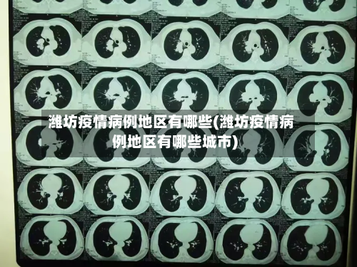 潍坊疫情病例地区有哪些(潍坊疫情病例地区有哪些城市)-第2张图片
