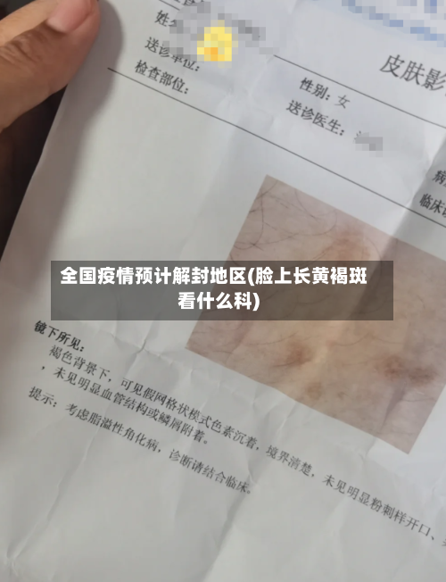 全国疫情预计解封地区(脸上长黄褐斑看什么科)-第3张图片