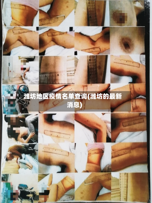 潍坊地区疫情名单查询(潍坊的最新消息)-第2张图片